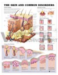 The Skin and Common Disorders Anatomical Chart